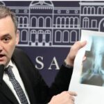LML    /Auditoría sobre discapacidad: detectaron miles de irregularidades